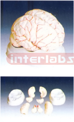 Brain with Arterial